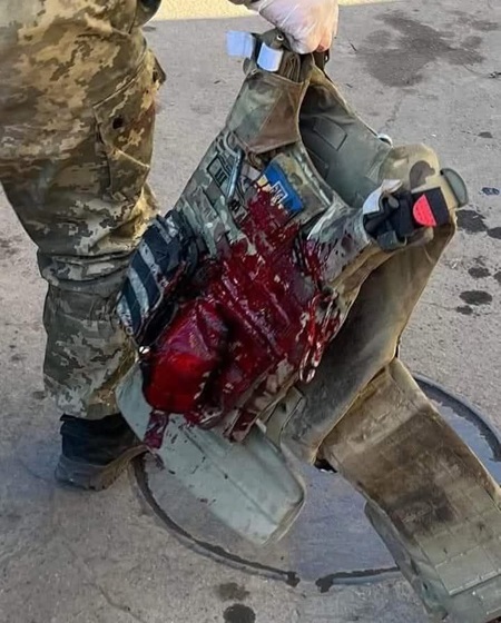 «Живий. Все нормально» – прості слова про непросте життя на виживання задля перемоги
